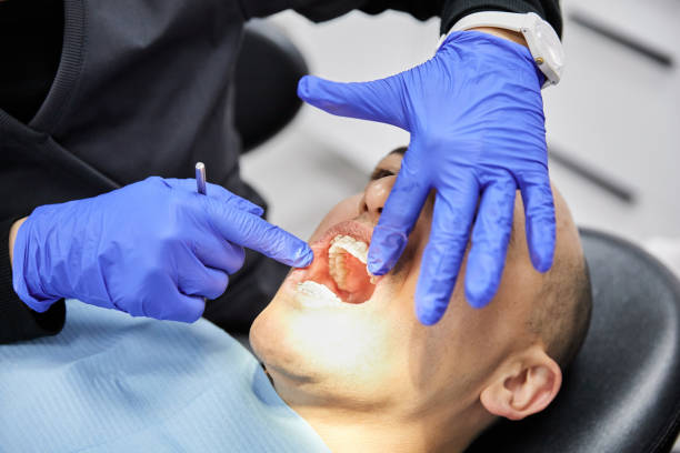 Best Emergency Dental Care for Abscessed Tooth in Kiawah Island, SC