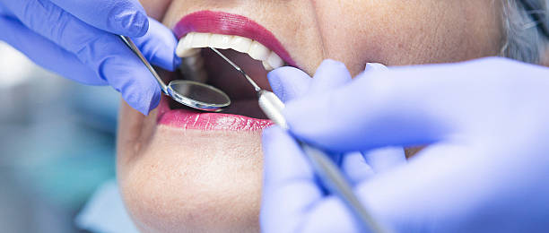 Best Emergency Dental Services for Seniors in Kiawah Island, SC